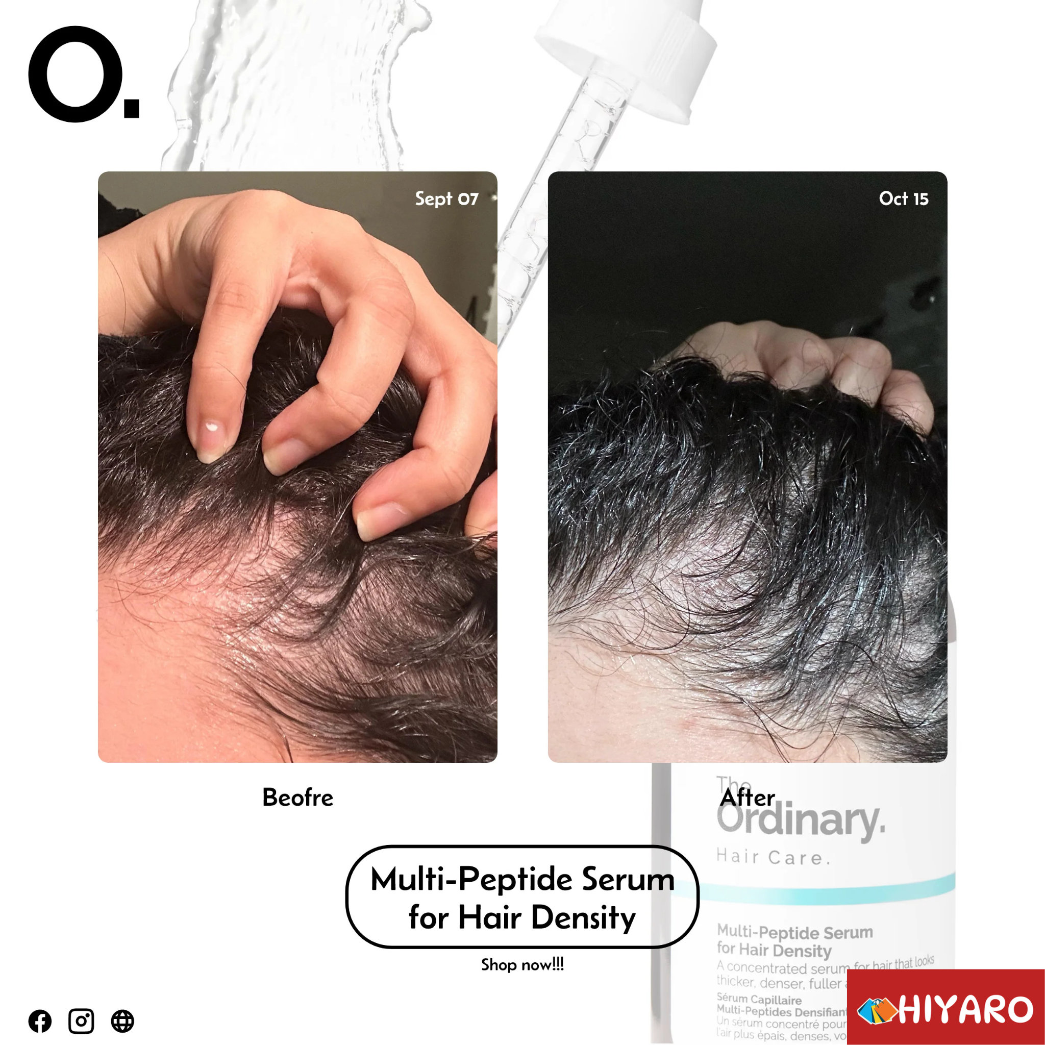THE ORDINARY MULTI-PEPTIDE SERUM FOR HAIR DENSITY 60ML -Canada 🇨🇦