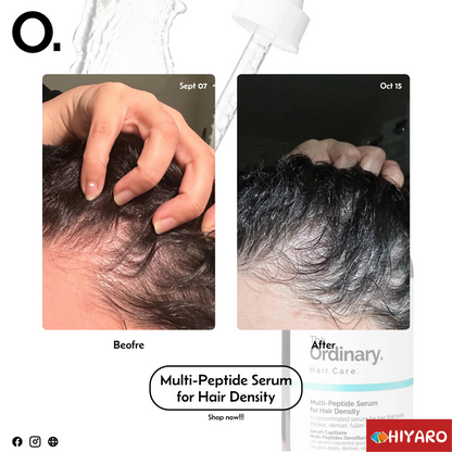 THE ORDINARY MULTI-PEPTIDE SERUM FOR HAIR DENSITY 60ML -Canada 🇨🇦