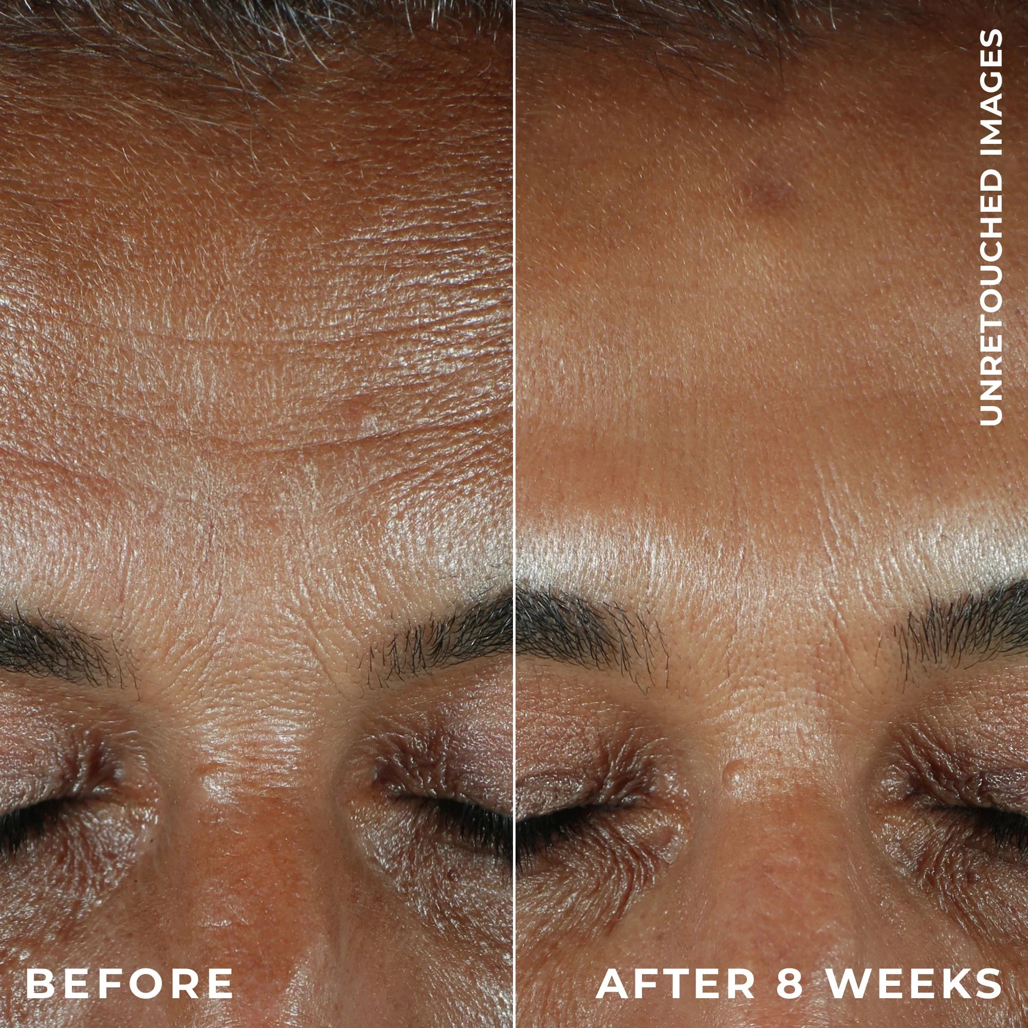 ROC MULTI CORREXION® REVIVE + GLOW DAILY SERUM