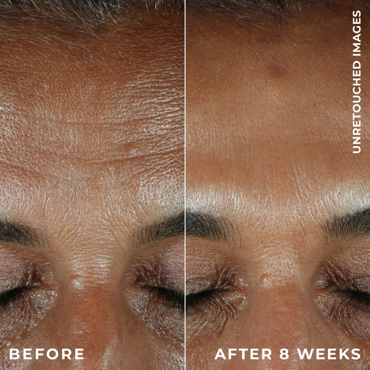 ROC MULTI CORREXION® REVIVE + GLOW DAILY SERUM