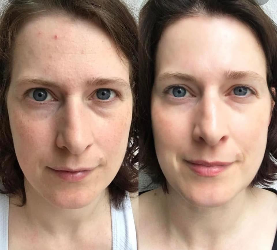 The Ordinary Retinol 0.2% in Squalane 30mL