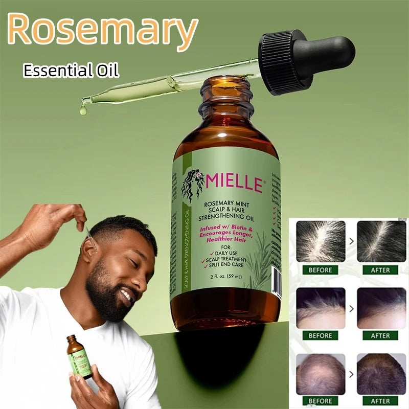 Mielle Rosemary Mint Scalp & Hair Strengthening Oil For Hair Loss Treatment 59ml - USA Variant