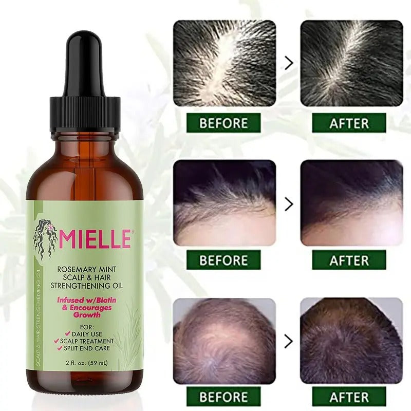 Mielle Rosemary Mint Scalp & Hair Strengthening Oil For Hair Loss Treatment 59ml - USA Variant